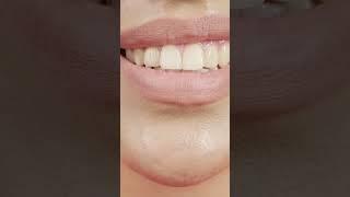 How to clean yellow tooth to white? Hanta ku haladiya ru dhala kemiti karibe?