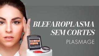 PLASMAGE 3D - Blefaroplasma sem cortes alternativa à blefaroplastia.