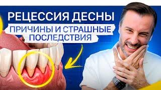 Неочевидная причина рецессии десны. Что делать если опустилась десна?