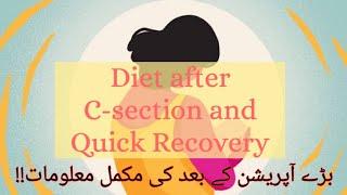 Diet after c-section & Quick recoveryUrduHindi