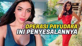 Ingin Kembali Jadi Pria Seutuhnya Millen Cyrus Menyesal Operasi Payudara