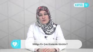 Vitiligo En Çok Kimlerde Görülür?