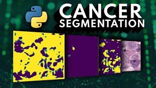I tried building an ML Cancer Segmentation API in 15 Minutes