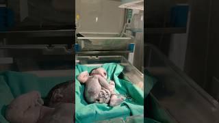 vernix cleaning #newbornbaby #baby #beautiful #babycare #new #viral #youtubeshorts #new #trending