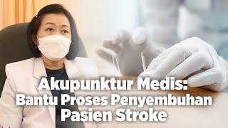 Akupunktur Medis Bantu Proses Penyembuhan Pasien Stroke