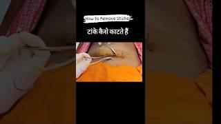 Stich Remove कैसे करें How to Remove Stiches टांके कैसे काटते है Sterile Procedure of stich Removal