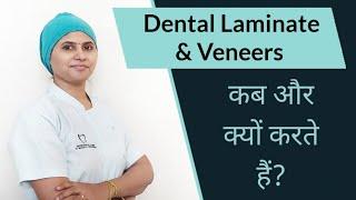 Dental Laminate & Veneers When? How? & Why l कब और क्यों करते हैं?