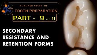 Fundamentals of tooth preparation  Part 9  Secondary resistance and retention form