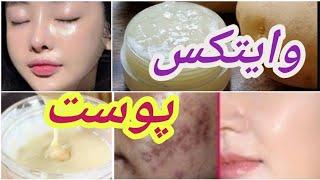 بهترین ماسک حذف لکه های تیره ی پوست راز زیبایی پوست زنان کره ای Mask to remove dark spots