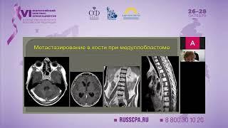 Желудкова Ольга Григорьевна - Опухоли центральной нервной системы у детей