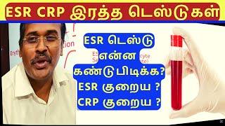 ESR vs. CRP Blood Tests for Detecting Inflammationவீக்கத்தைக் கண்டறிவதற்கான இரத்த பரிசோதனைகள்