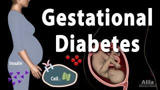 Gestational Diabetes Animation