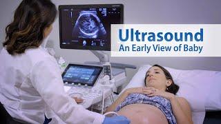 ULTRASOUND An Early View of Baby