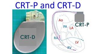 CRT-P and CRT-D