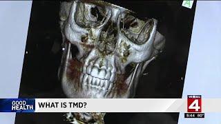 Good Health What is TMD?