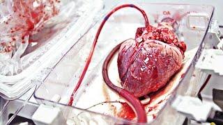 TransMedics Pumping Heart  WIRED