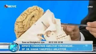 BEYİN VE SİNİR CERRAHİ UZMANI OP. DR. HAKAN YAKUPOĞLU - BEYAZ TV BAŞKENTTEN SAĞLIK 24.10.2015