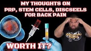 My thoughts on PRP Stem Cells and Discseels for back pain