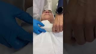 Is HIFU a better alternative for Fat breakdown and Skin tightening for our face compare to surgery?