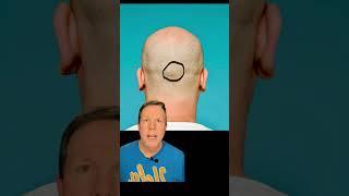 The external occipital protuberance #dreldersanatomychannel