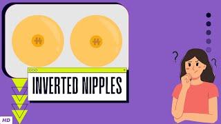 Inverted Nipples Everything You Need To Know