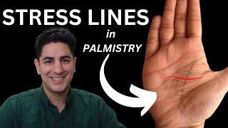 Stress Lines and Trauma Lines on the Palms