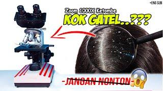 MAKHLUK HALUS DI KETOMBE KITA  Dundruff in Microscope Zoom 1000X