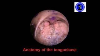 Anatomy of The Tongue Base