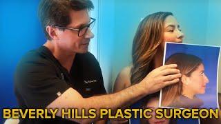 Rhinoplasty Result by Dr. Jay Calvert Beverly Hills Plastic Surgeon