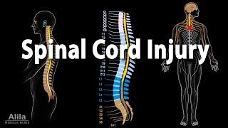 Spinal Cord Injury Animation