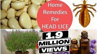 Top 5 Home Remedies To Get Rid Of Head LICE & Nits * Sushmitas Diaries