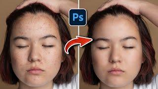 Face Smooth In Photoshop  Easy Frequency Separation Tutorial