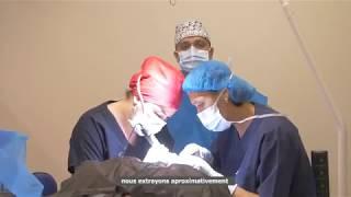 Greffe de cheveux  Capilclinic  Extraction des follicules avec le Dr. Oguz Kayiran