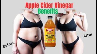 Does Apple Cider Vinegar Really Help You Lose Weight? - Apple Cider Vinegar Benefits