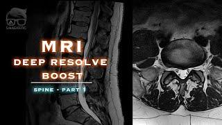 MRI DEEP RESOLVE BOOST –SPINE – PART1