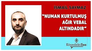 İSMAİL SAYMAZ -CAN ATALAY NUMAN KURTULMUŞ AĞIR VEBAL ALTINDADIR * Köşe Yazısı Dinle *