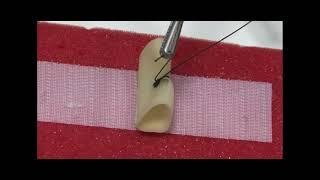 Suturing with the Endostitch Device