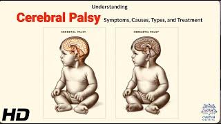 Cerebral Palsy Identifying Symptoms and Understanding Causes