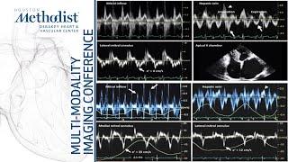 Pericardial Diseases EchoCTCMR-Complementary or Redundant?M Malahfji MD F Nabi MD June 7 2022