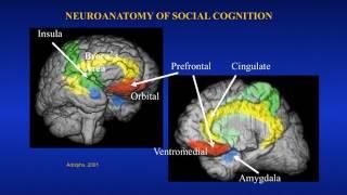 Uniquely-Human Features of the Brain Katerina Semendeferi-Human Specializatons of the Social Brain