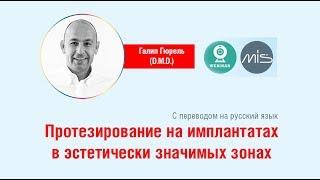 D.M.D Galip Gürel - Вебинар Протезирование на имплантатах в эстетически значимых зонах