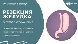 Резекция желудка гастропластика слив. Все что нужно знать об операции