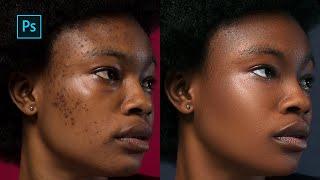 High-End skin Retouching Photoshop Tutorial  Frequency Separation