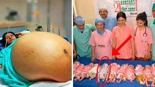 Mother Gives Birth to 10 Babies and Doctors Realize One of Them Isnt a Baby Biggest Shock