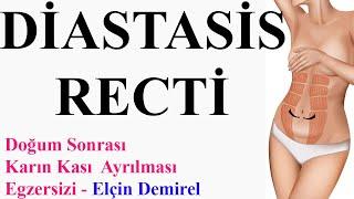 Doğum Sonrası Diastasis Recti Karın kası ayrılması Egzersizi