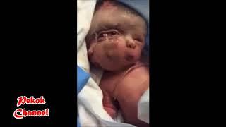 Bayi mungil mirip dewa hindu lahir di Iran