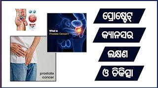 Know About Prostrate Cancer #odiashorts #odiabhaipk #odiahelthtips