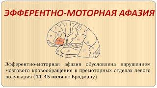 Эфферентно-моторная афазия. Практическая часть.