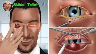 Asmr Animation Skibidi Toilet treats eye injuries caused by wearing eyeglasses for satisfying video