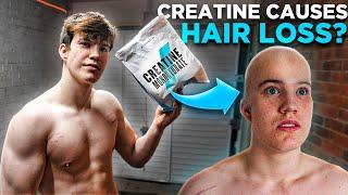 Does Creatine Cause Hair Loss?